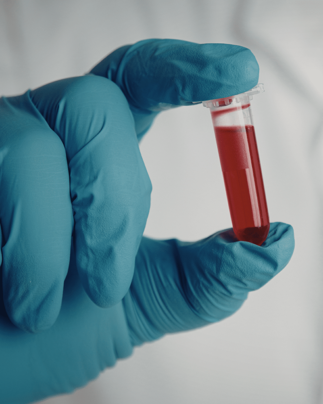 Prenatal Testing Explained